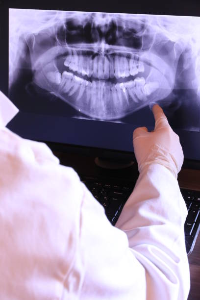 Best Emergency Dentist for Lost Fillings or Crowns in Granville South, OH